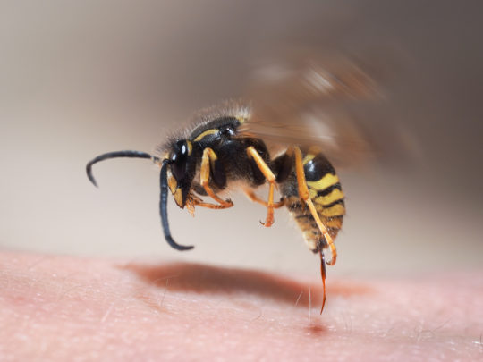 Bee and Wasp Stings